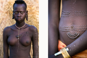 Two pictures of the torso of a young Mursi Woman with Scarification , Ethiopia